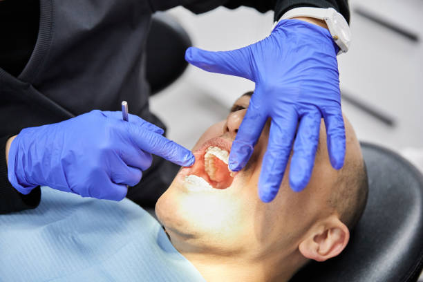 Best Emergency Wisdom Teeth Removal in Tracy City, TN